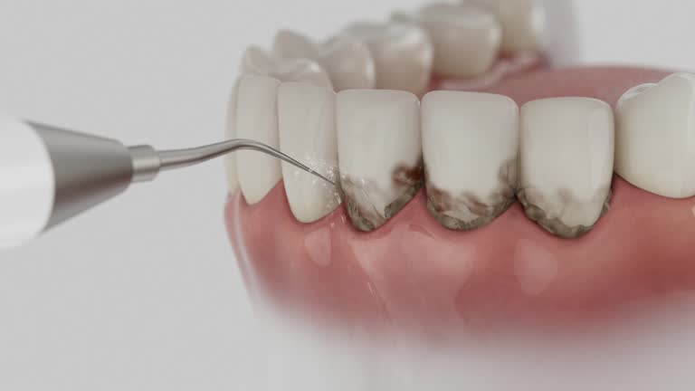 Trusted Teeth Cleaning And Checkup service in Oregon, WI - Dentist Open Now
